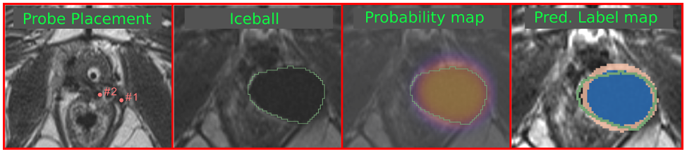 Iceball prediction